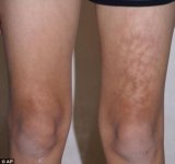 toasted-skin.jpg